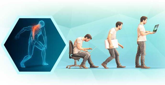 postură proastă când se lucrează la computer și osteocondroza toracică