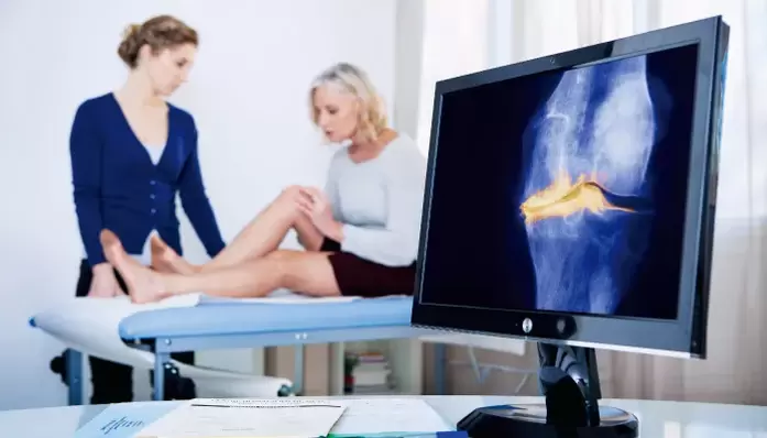 Artroza articulației la o femeie